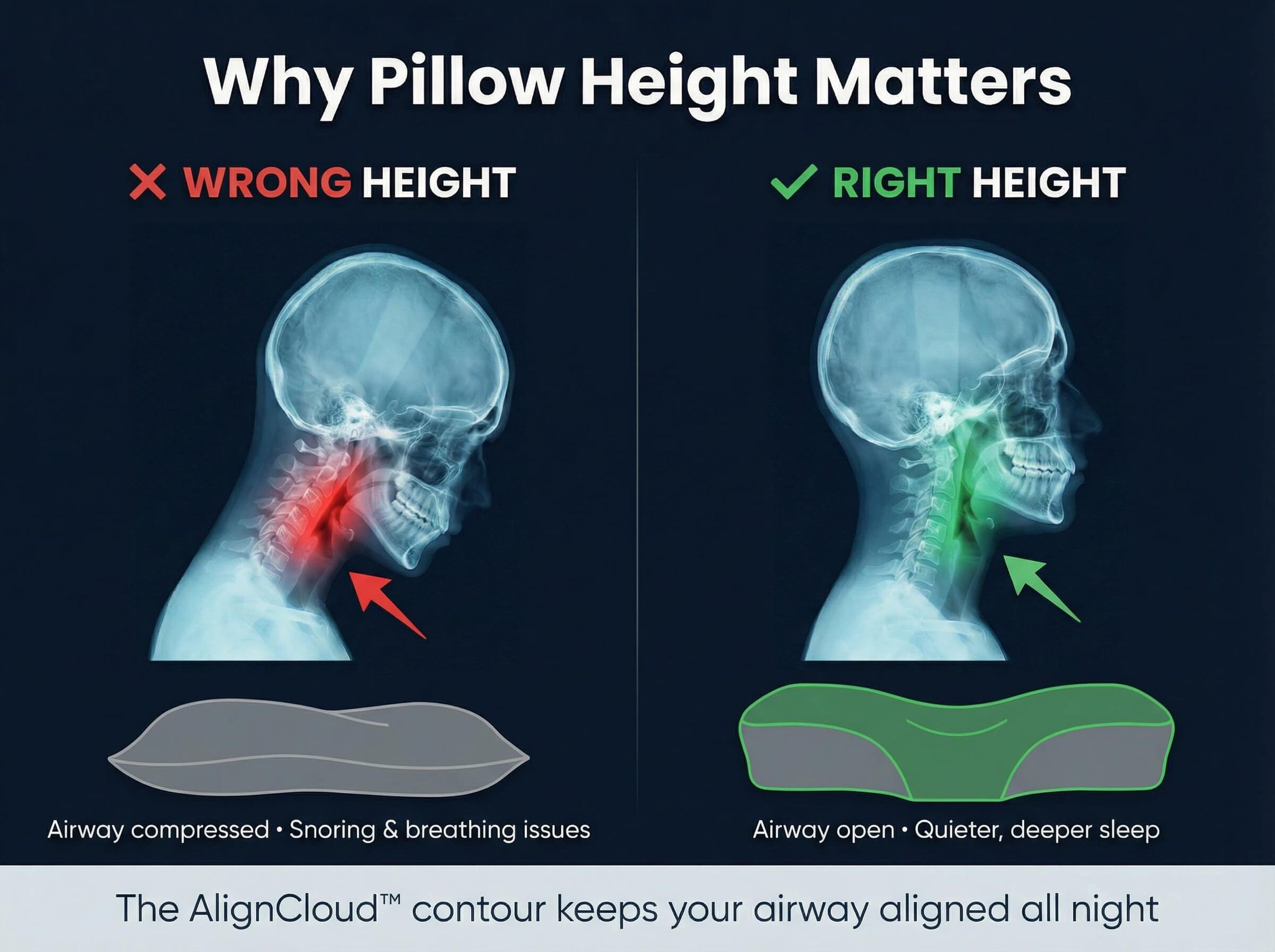 Menoola AlignCloud™ Contour Pillow